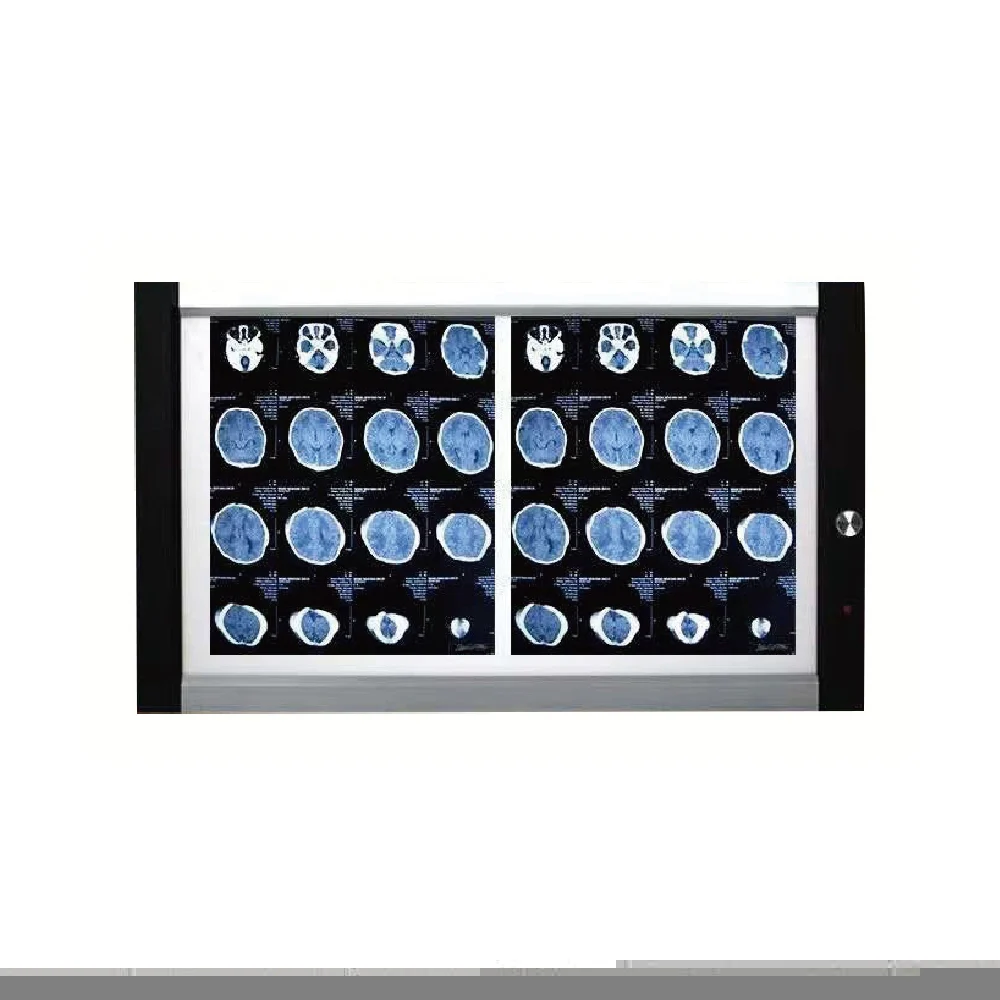 dual-panel-led-viewing-box-medical-xray Double panel LED viewing box with 720x425mm visual area and 4500cd/m² brightness