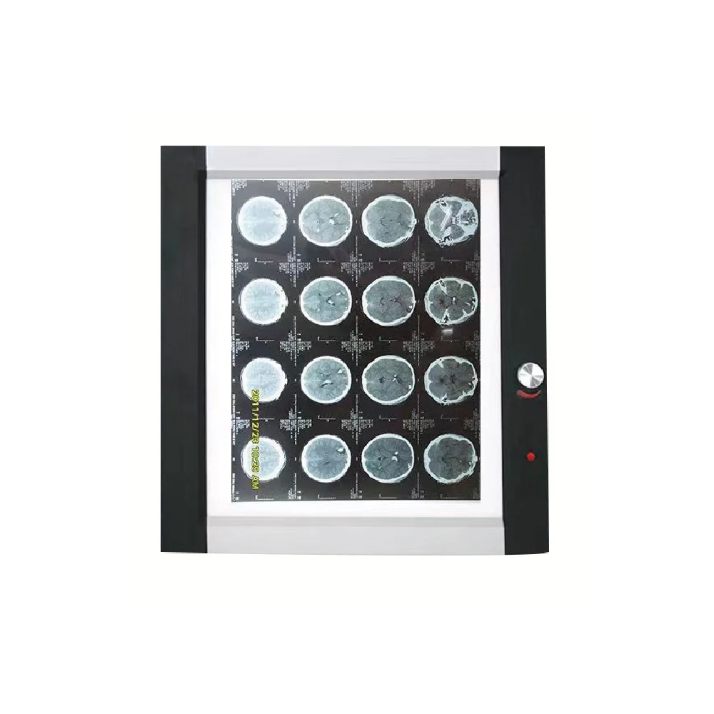 single-panel-led-viewing-box-4500cd-medical Single panel LED viewing box with 360x425mm visual area and 4500cd/m² brightness