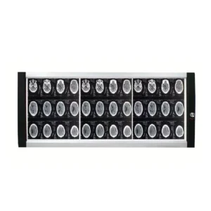 Triple-panel LED medical viewing box with 1080×425mm viewing area