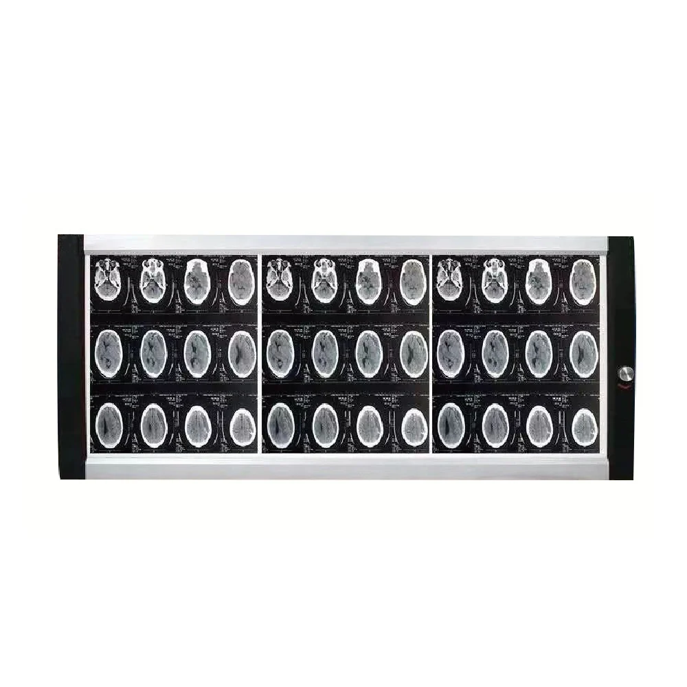 triple-panel-medical-viewing-box-1080mm Triple-panel LED medical viewing box with 1080×425mm viewing area